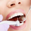 Кариес зубов: причины возникновения